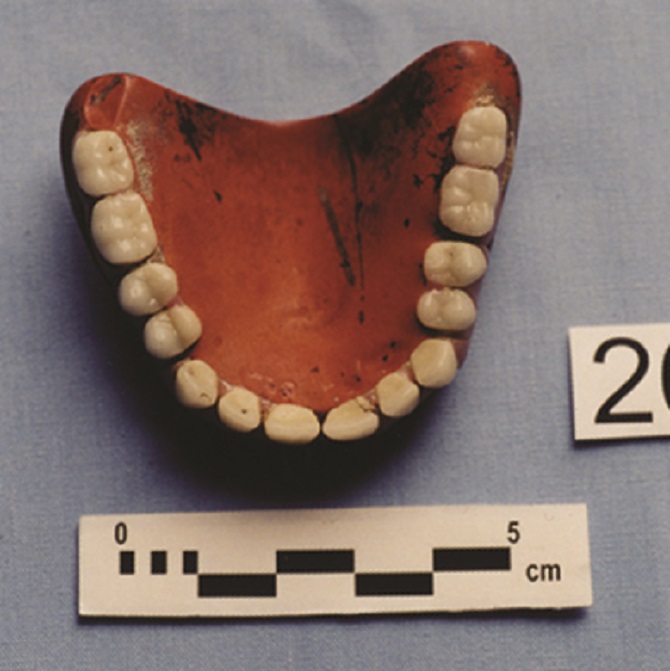 Upper dentures